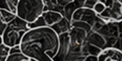 Microstructure Analysis